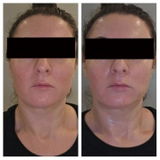 Anonym review photo