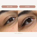 Ledi review photo