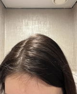 Anoniem review photo