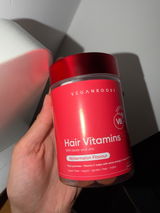 Anoniem review photo