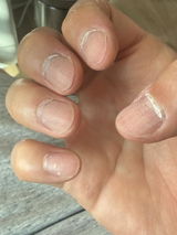 losely review photo
