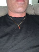 Anonymous review photo
