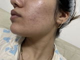 M. review photo