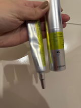 Anonim review photo