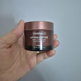 Anonim review photo
