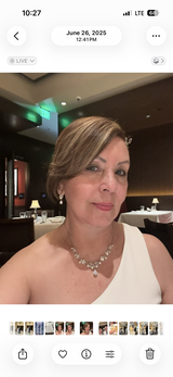 Anonymous review photo