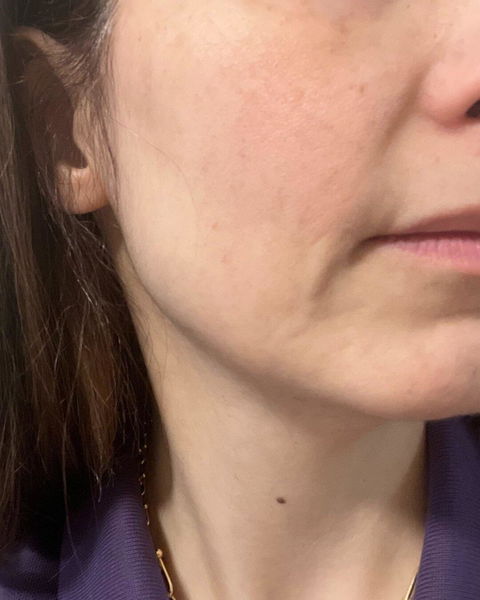 Niacera Lift Cream