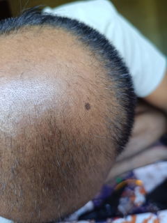 Review picture