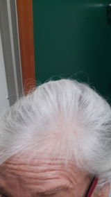 Ann review photo