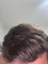 Grow Me Shampoo - Rosemary Oil, Biotin, Niacinamide & Caffeine