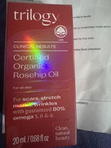 Loyce review photo