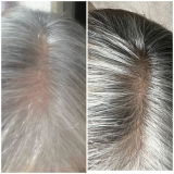 Estere review photo