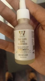 Anonymous review photo