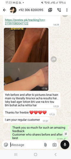 Review picture