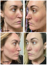 Sommer C. review photo