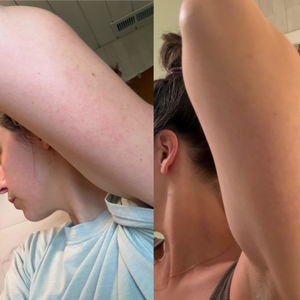 Customer review photo