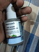 Akash review photo