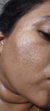 Excellent and effective for skin brightening review photo