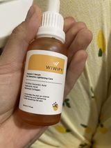 Anonim review photo