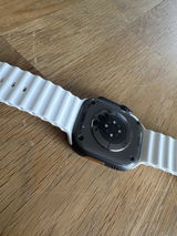 Anonym review photo