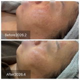 esthetic simple review photo