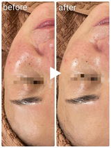 Glowthera nurse salon review photo