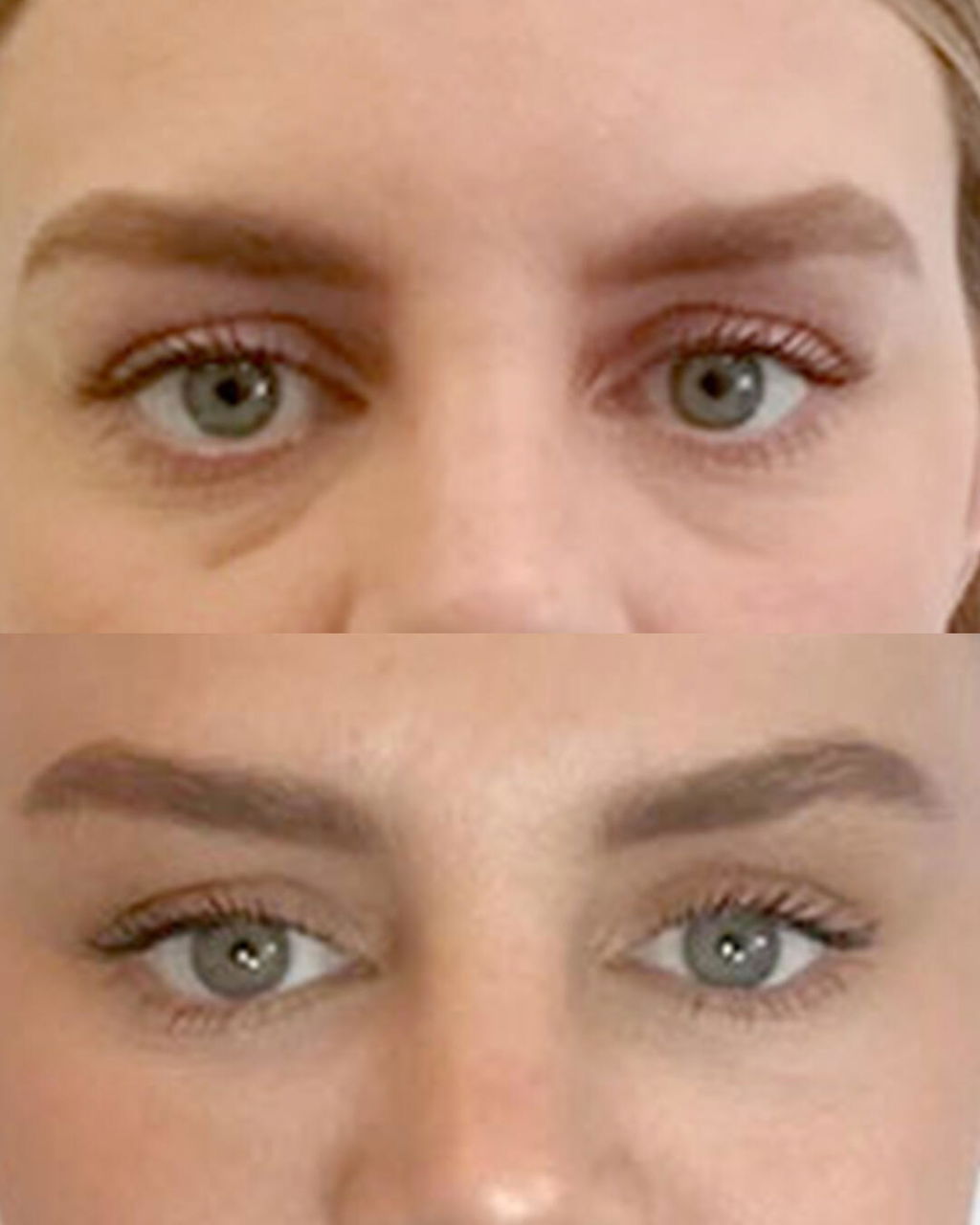 ISA 💕✨ VARITA MAGIC LED FACIAL