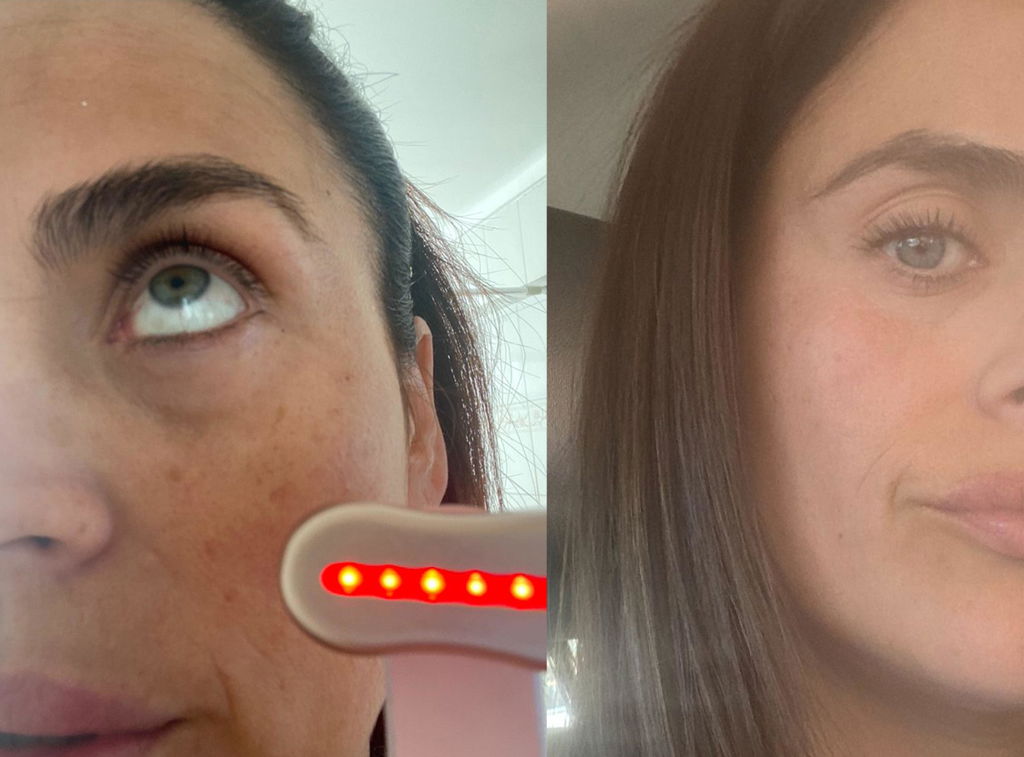 ISA 💕✨ VARITA MAGIC LED FACIAL