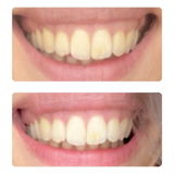 Milly review photo