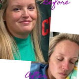 Anonymous review photo