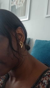 Anonyme review photo