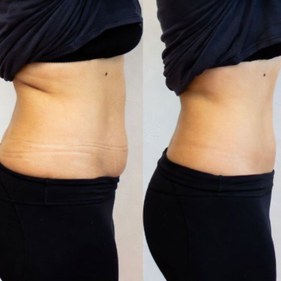 Customer photo - Florêve Slim Inside® hunger relief & sat…
