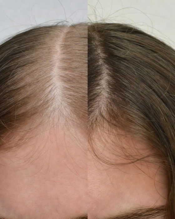 Customer photo - Florêve [IN] YOUTH Anti-Hair Loss