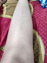 Nalini Chopra review photo