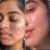 Simran review photo