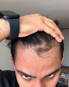 Review picture