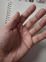 Anonymous review photo