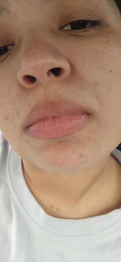 Review picture