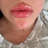 Mfcxnfno review photo