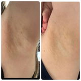 Emily Van der Merwe review photo