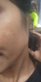 Anonymous review photo