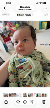 Anonymous review photo